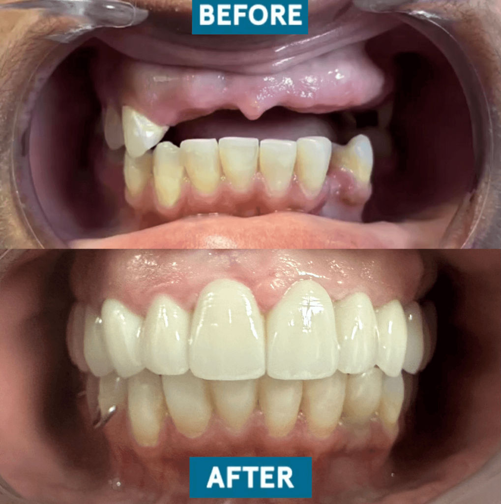 before and after dr franco case 10