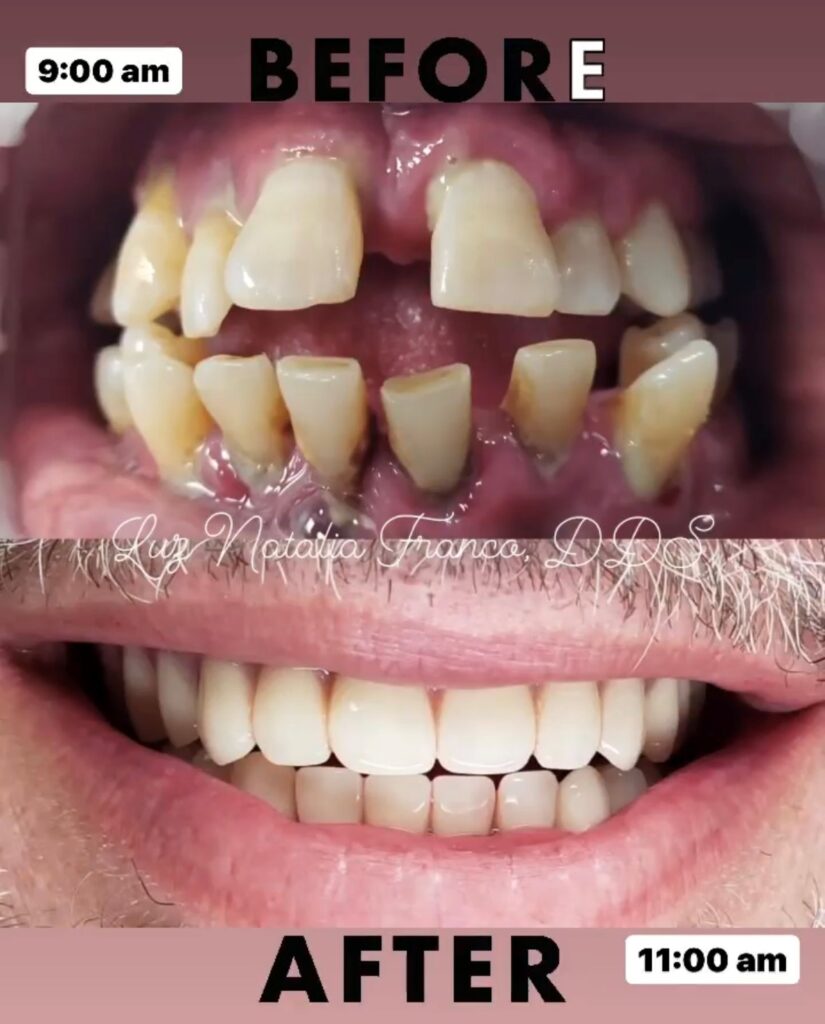 before and after dr franco case 5