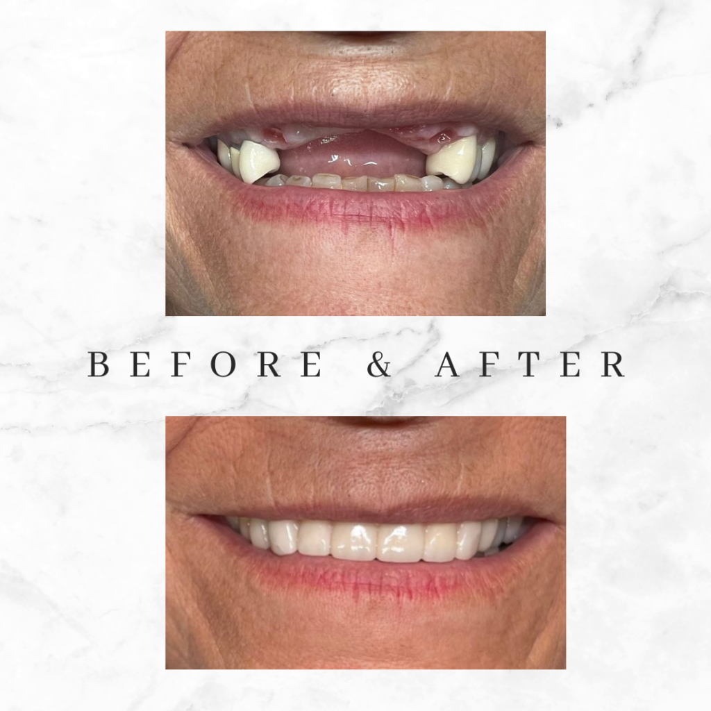 before and after dr franco case 8