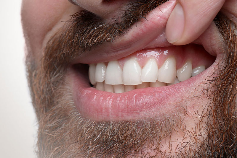 gum disease