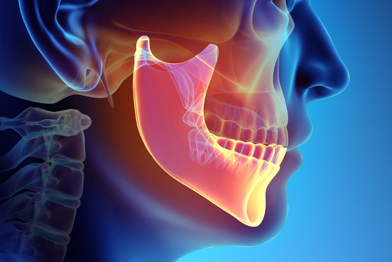 jaw bone model