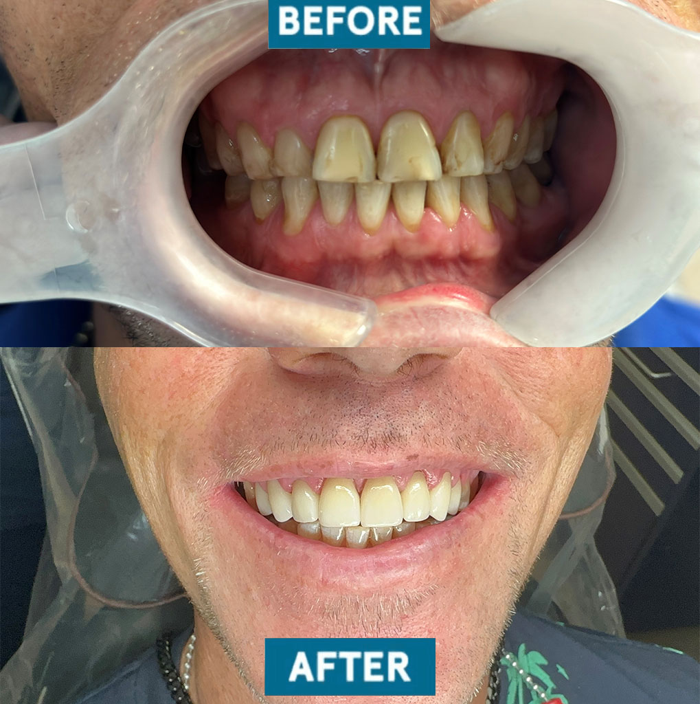 before and after dr franco case 9